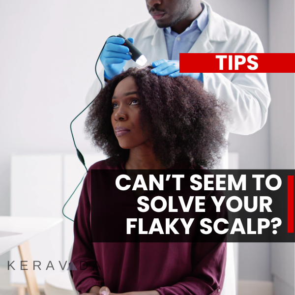 Dandruff or Seborrheic Dermatitis in African American or 4c hair types